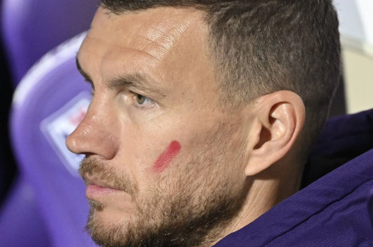 Džeko je meč protiv Juventusa odgledao s klupe
